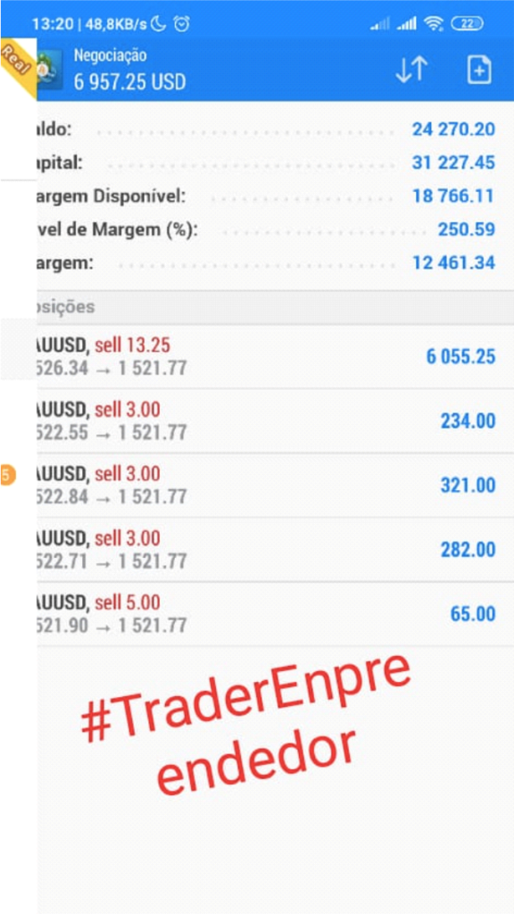 forex1